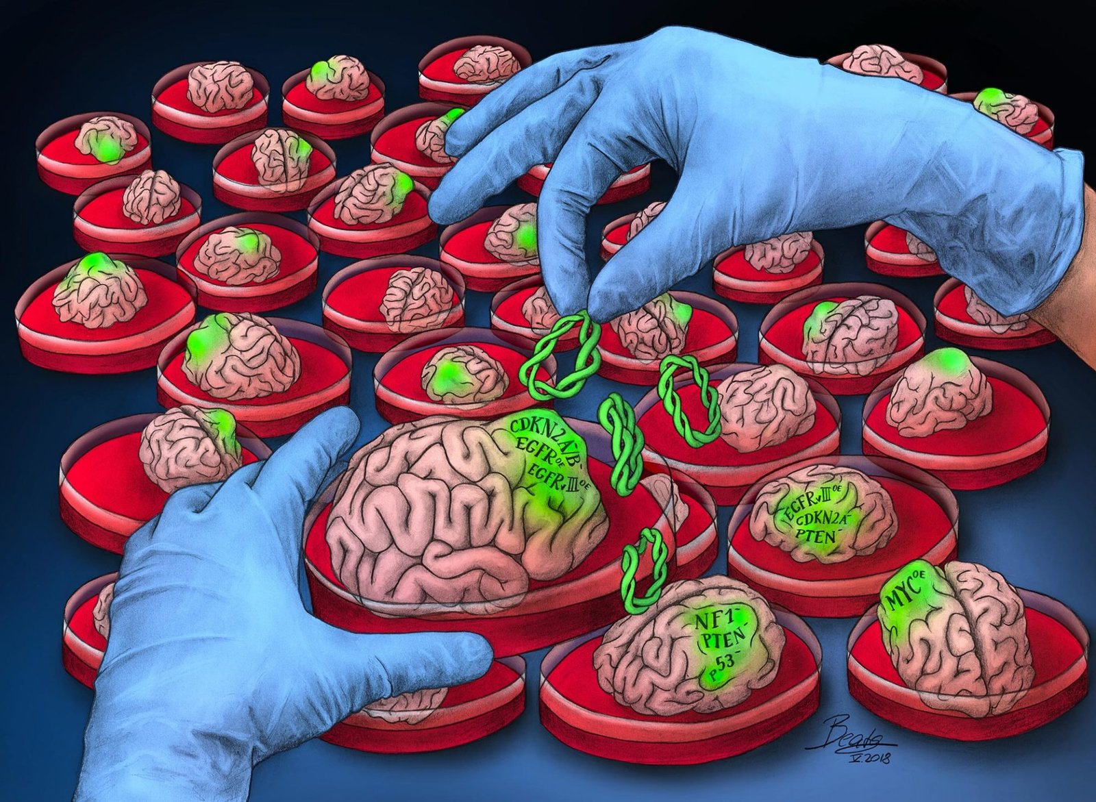 Growing Brain Cancer in Petri Dishes